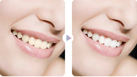Dentifrice à la niacinamide avec menthe Rafraîchit les dents Nettoie l'haleine Blanchit les dents Utilisation à domicile