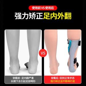Correcteur de pied tombant fourni par le fabricant, support interne du pied, correction de la cheville, équipement d'entraînement, dispositifs de correction de traction - Product Image 5