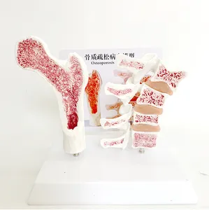 人間の骨格モデル解剖学的椎骨脊柱骨粗松症モデル4椎骨人間の解剖学的骨格骨モデル