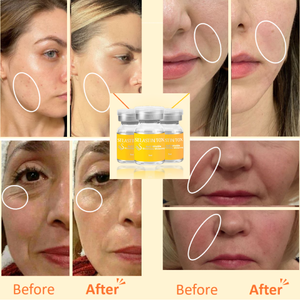 Suero Ampolla OEM ODM Antiarrugas, Blanqueador y Reductor de Poros, SELASTIN TOX GF11, Complejo de Factores de Crecimiento para Rejuvenecimiento de la Piel - Product Image 2