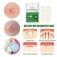 Patchs hydrocolloïdes pour l'acné, autocollants pour les imperfections du visage et de la peau, respirants, imperméables, doux, non irritants, 24/36 pièces