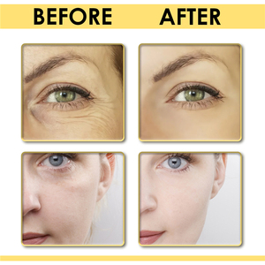 OEM Orgánico Retinol Reafirmante Lifting Serum Patas de gallo Pliegues nasolabiales Fruncir el ceño Estria <span class=keywords><strong>perioral</strong></span> Eliminación Belleza Cuidado DE LA PIEL Suero - Product Image 2