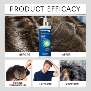 Shampooing pour hommes à marque privée, antipelliculaire, anti-chute, stimulant la croissance des cheveux, renforçant les racines et épaississant les cheveux - Product Image 5