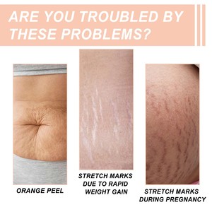 Crème hydratante lissante Herbicos la plus vendue pour l'élimination des cicatrices et des vergetures à l'essence de bave d'escargot - Product Image 3
