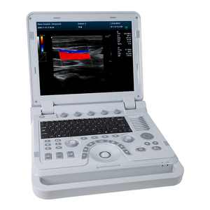 Contec cms1700b 4d scanner de diagnóstico, cor doppler usg ultrassom cardiac máquina de diagnóstico micro convexo sonda - Product Image 6