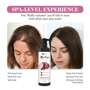 Champú <span class=keywords><strong>de</strong></span> Cebolla Roja para Uso Doméstico, Fortalece y Revitaliza la Raíz del Cabello, Anti-Rotura, con Ingredientes Naturales, <span class=keywords><strong>Precio</strong></span> al por Mayor - Product Image 3