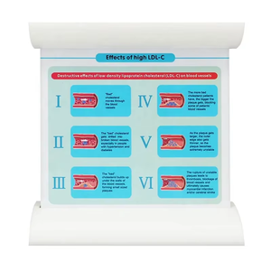 Comparaison de démonstration du flux de cohérence sanguine dans le PVC Modèle de blocage dynamique des vaisseaux de l'hyperlipidémie humaine pour la science médicale - Product Image 6