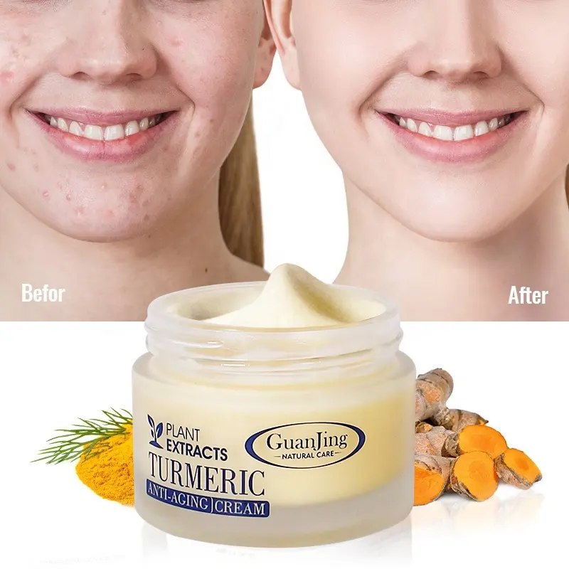 Private Label anti acne turmeric face cream moisturizing whitening skin care lightening natural organic facial Tumeric Cream