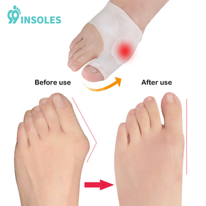 99 semelle intérieure avant-pied coussin séparateur d'orteils correcteur d'oignon <span class=keywords><strong>Hallux</strong></span> <span class=keywords><strong>Valgus</strong></span> gros orteils coussinets avant-pied <span class=keywords><strong>pour</strong></span> femmes <span class=keywords><strong>Hallux</strong></span> <span class=keywords><strong>Valgus</strong></span> - Product Image 6