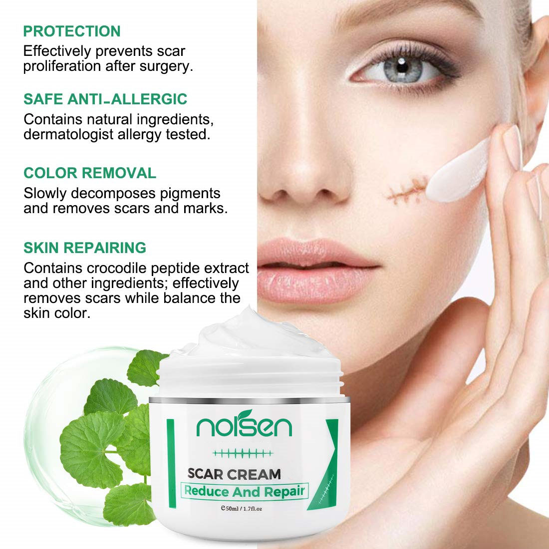 Hot Selling Acne Scar Stretch Marks Remover Cream Skin Repair Face Cream Acne Spots Acne Treatment korea Whitening Cream