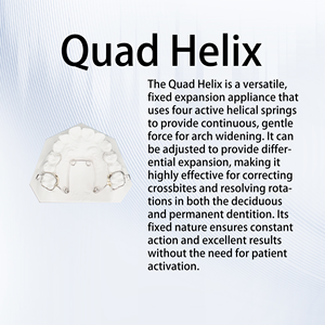 อุปกรณ์จัดฟันแบบ Quad Helix สำหรับขยายหลังคาฟัน แก้ไขปัญหาฟันกัดแบบไขว้ ปรับแต่งได้ตามต้องการ - Product Image 2