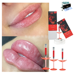 Proveedor <span class=keywords><strong>de</strong></span> Servicios OEM, Relleno Dérmico Monofásico <span class=keywords><strong>de</strong></span> 1 ml, Inyección <span class=keywords><strong>de</strong></span> VB12 para <span class=keywords><strong>Aumento</strong></span> <span class=keywords><strong>de</strong></span> <span class=keywords><strong>Labios</strong></span> Premium M <span class=keywords><strong>de</strong></span> 1 ml - Product Image 1