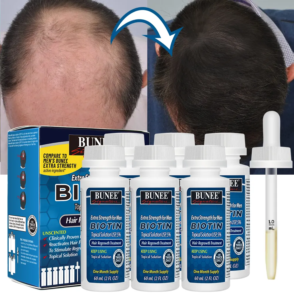 Oem kit 6 em 1 de 60ml, booster, mais grosso, biotin, soro de cabelo para crescimento