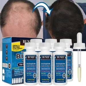 Kit 6 en 1 de 60ml de aceite de suero para el cabello, potenciador del cabello de biotina más gruesa, para el crecimiento, OEM Kirland