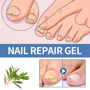 Hot Anti fungino Cream Nail Hand Foot Nail Fungus Removal Gel Anti infezione onicomicosi Nails Repair unguento 20g - Product Image 3