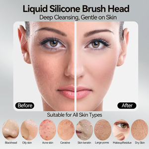 Nouvelle version améliorée Brosse nettoyante et chauffante électrique pour le visage Appareil de beauté Brosse exfoliante en silicone pour le nettoyage du visage - Product Image 5