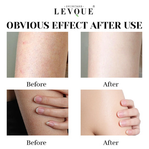Gel Douche Végétalien Marque Blanche aux Extraits d'Abricot Hydratant et Rafraîchissant, <span class=keywords><strong>Lait</strong></span> Corporel Nourrissant à Base de Plantes - Product Image 5