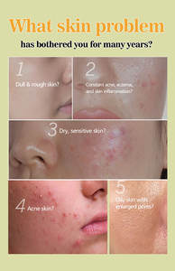 สบู่ดำแอฟริกันออร์แกนิค ชีอาบัตเตอร์ บำรุงผิวล้ำลึก ขนาด 100 กรัม ลดราคาพิเศษ - Product Image 5