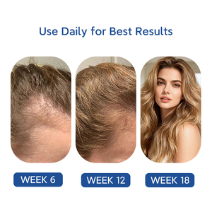 Aceite Esencial Natural Orgánico de Romero y Arborvitae para el Crecimiento del Cabello, Aceite para Masaje del Cuero Cabelludo, Suero Anticaída para Hombres y Mujeres - Product Image 6