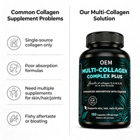 Capsules de complexe multi-collagène types I, II, III, V, X pour la peau et les articulations, capsules de peptides de collagène hydrolysés