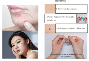 ATO แพทช์ดูแลจุดด่างดำไฮโดรคอลลอยด์แผ่นแปะสิวเพื่อสุขภาพและความงาม - Product Image 5