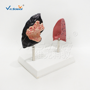 Modèle anatomique médical pour le tabagisme Modèle d'<span class=keywords><strong>anatomie</strong></span> humaine médicale Modèle de comparaison du <span class=keywords><strong>poumon</strong></span> fumeur de <span class=keywords><strong>poumon</strong></span> humain - Product Image 4