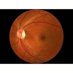 معدات طب العيون تصوير قاع الشبكية غير الفطري التصوير الفوتوغرافي الرقمي قاع العين - Product Image 5