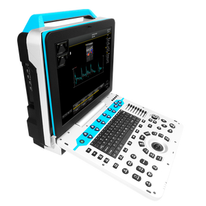Sistema Diagnostico Veterinario a Ultrasuoni Doppler da 15 Pollici per <span class=keywords><strong>Esame</strong></span> Ostetrico di Bovini, Cavalli, Suini, Ovini, Cani e Gatti - Product Image 1