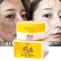 Crème éclaircissante anti-taches à l'astragale pour le visage – Élimine les taches brunes, le mélasma, atténue la mélanine, les cicatrices d'acné, anti-âge, illumine la peau noire