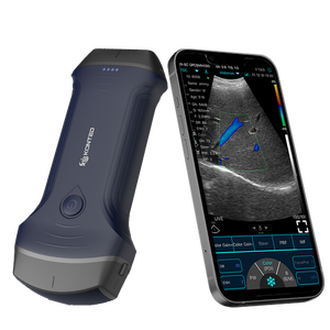 Scanner Ecografico Wireless 3 in 1 Konted C10RLpro con Doppia Sonda Lineare e Convessa, Ecografo Portatile con Doppler a Colori - Product Image 2