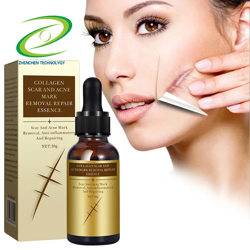 UONOFO-suero facial de colágeno, tratamiento de marcas de acné, Alisador, aceite anticicatrices, 30ml, gran oferta