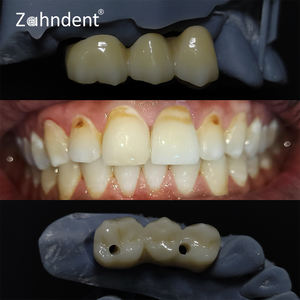 I tecnici hanno utilizzato HT White Shaded Milling Blank <span class=keywords><strong>CAD</strong></span> <span class=keywords><strong>CAM</strong></span> 10-30mm Zirconia Blocks <span class=keywords><strong>Dental</strong></span> Lab Porcelain impiallacciature denti - Product Image 4