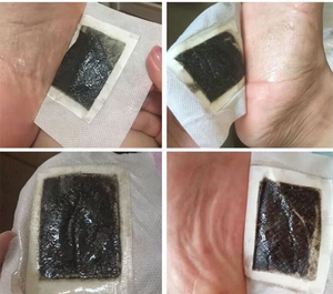 Nuevos productos 2024 Paquete personalizado Parche <span class=keywords><strong>para</strong></span> <span class=keywords><strong>pies</strong></span> <span class=keywords><strong>para</strong></span> dormir - Product Image 5