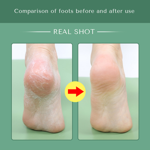 Main orange de vitamine E de citron blanchissant apaisant éclaircissant la crème et la lotion de <span class=keywords><strong>pieds</strong></span> personnalisées - Product Image 3