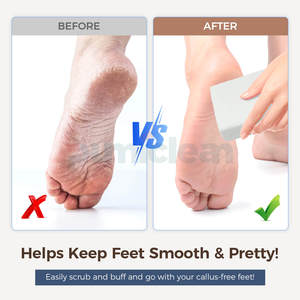Meilleures ventes 1 pièce <span class=keywords><strong>Pierre</strong></span> <span class=keywords><strong>ponce</strong></span> pour les pieds Bloc éponge pour éliminer les callosités pour le gommage des pieds - Product Image 6