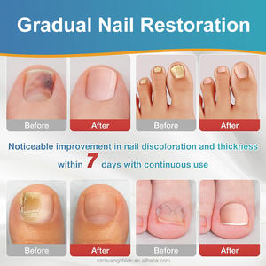 SAMVO Herbal 8-Jam Perawatan dan Pelindung Kuku Kaki dari Jamur dengan Gel dan Hasil Cepat & Terlihat - Product Image 4