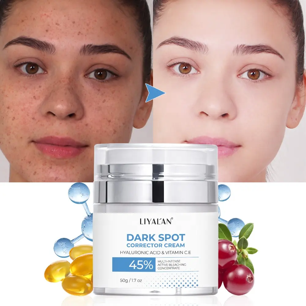 Private Label Pimples Melasma Blemish Freckle Removal Face Cream Strong Bleaching Whitening Dark Spot Corrector Remover Cream