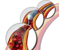 Machine de tressage horizontale QX90-36-1 pour l'utilisation d'hôpital de stent cardiaque de stent de chirurgie de stent cardiaque