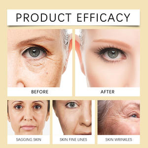 Marque privée 100% pur brut naturel Massage diffuseur huiles essentielles pour le visage sérum soins de la peau compte-gouttes huile pour le visage - Product Image 6