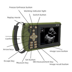 Harga hewan <span class=keywords><strong>Mini</strong></span> genggam pemindai <span class=keywords><strong>Ultrasound</strong></span> medis S0 sonosape <span class=keywords><strong>Ultrasound</strong></span> perangkat untuk domba babi - Product Image 6