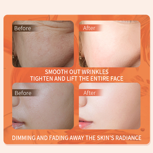 Crema Antiedad y Antiarrugas para el Cuidado Facial que Blanquea e Hidrata Profundamente - Product Image 6