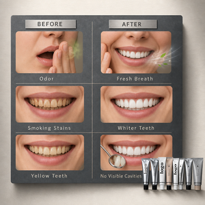 Pasta Dental Blanqueadora con Aliento Fresco, Limpieza Profunda, Elimina la Placa, Blanquea los <span class=keywords><strong>Dientes</strong></span>, Pasta Dental Blanqueadora Personalizada, Fábrica de Pasta Dental - Product Image 2