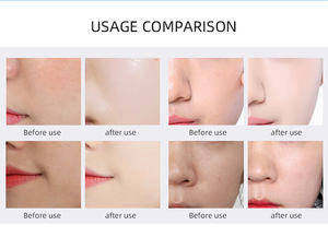 Hydra 산소 페이셜 CO2 버블 개선 수분 유지 스킨 케어 산소 물 스프레이 페이셜 산소 기계 - Product Image 6