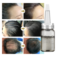 Sérum capillaire pour la croissance des cheveux, marque blanche, Huile et Lotion de croissance pour femmes et hommes, Produits de repousse des cheveux