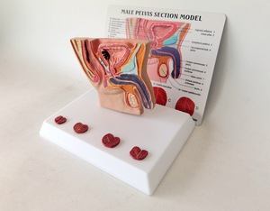 Modelo Anatómico de Pelvis Masculina Humana con Enfermedad Sagital en 4 Etapas, Anatomía de la Cavidad Pélvica, Ciencia Médica - Product Image 4
