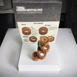 Modelo vascular humano anatómico de cuatro etapas para la ciencia médica que ilustra la <span class=keywords><strong>arteriosclerosis</strong></span> y la <span class=keywords><strong>enfermedad</strong></span> vascular - Product Image 2