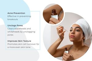 Tratamiento para el Acné con Ácido Salicílico, Suero con 1.5% de SA y Niacinamida para Piel Propensa a Imperfecciones, Elimina el Acné, Esencia GZ RTS, Pedido Mixto al por Mayor - Product Image 2