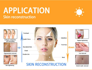 <span class=keywords><strong>2025</strong></span> mới nhất da tái tạo bề mặt fractional <span class=keywords><strong>CO2</strong></span> <span class=keywords><strong>Laser</strong></span> máy đẹp âm đạo thắt chặt <span class=keywords><strong>Laser</strong></span> <span class=keywords><strong>CO2</strong></span> <span class=keywords><strong>Laser</strong></span> máy đẹp - Product Image 4