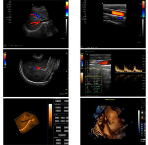Ecógrafo Veterinario Portátil de Imágenes Nítidas con Sonda, <span class=keywords><strong>Precio</strong></span> de Ultrasonido Veterinario - Product Image 3
