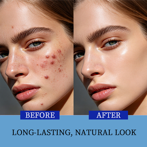 Nettoyant Quotidien Visage OEM/ODM Contrôle Sébum Exfoliant Peaux Mortes Resserre les Pores Élimine les Imperfections et les Éruptions Cutanées - Product Image 2